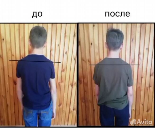 Массаж. Мягкие мануальные техники