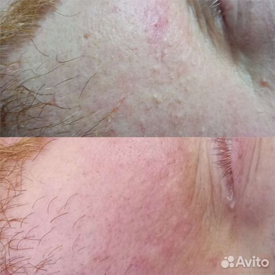 Безъиньекционная уходовая косметология