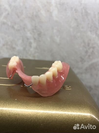 Съемные зубные протезы