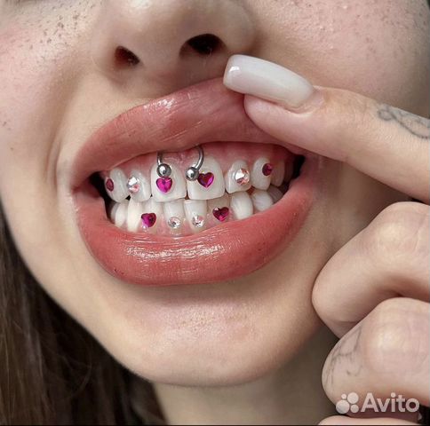 Установка скайсов