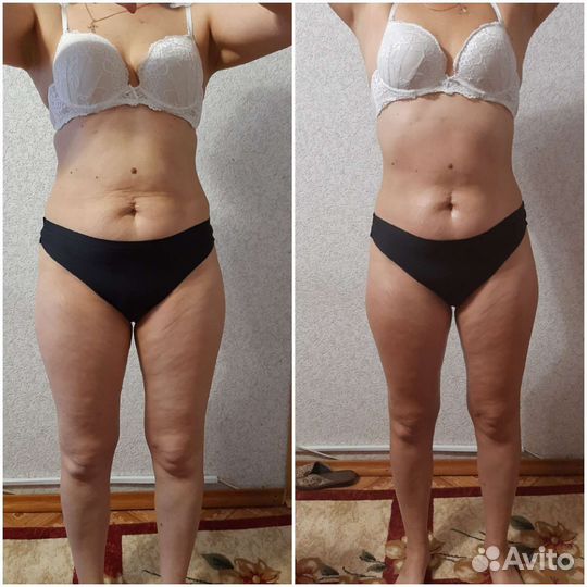 Массаж на дому