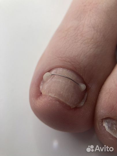 Модель на титановую нить (педикюр)