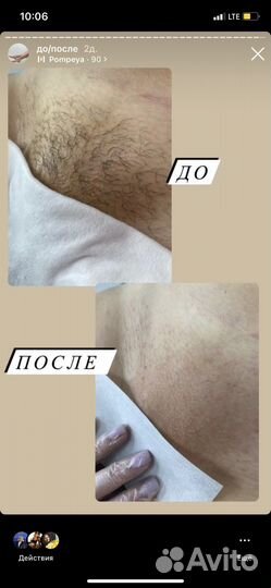 Мастер восковой депиляции
