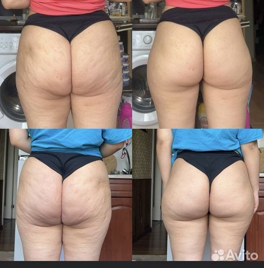 Массаж, реабилитация и коррекция фигуры для женщин