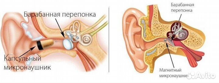 Микронаушник магнитный