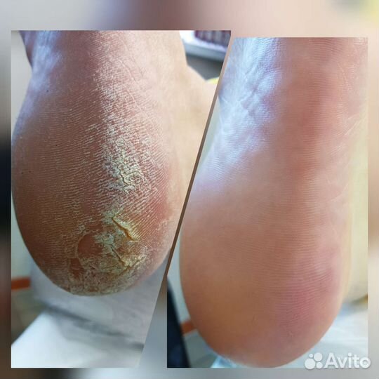 Smart педикюр(и мужской ), маникюр, наращивание