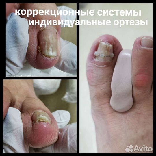 Подолог опытный
