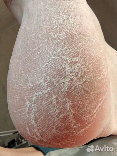 Педикюр модели