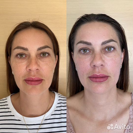 Массаж лица