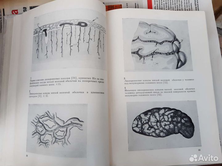 Функциональная стереоморфология мозговых оболочек