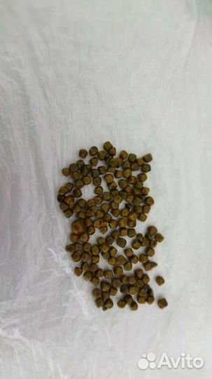 Камни из желчного пузыря человека