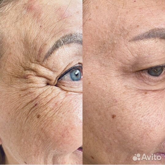 Курсы косметолога