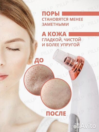 Вакуумный очиститель пор косметолог от прыщей
