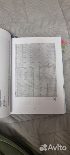 Большой атлас экг