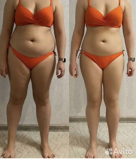 Точка голода, гиперсушка, липолитики