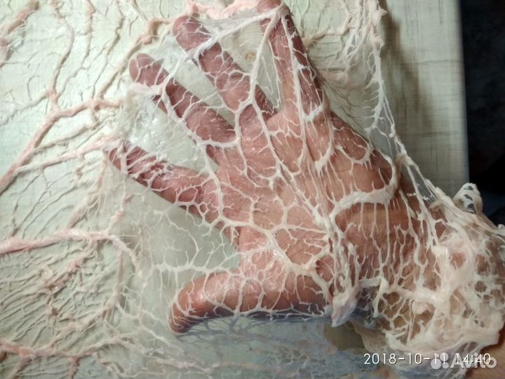 Сетка жировая