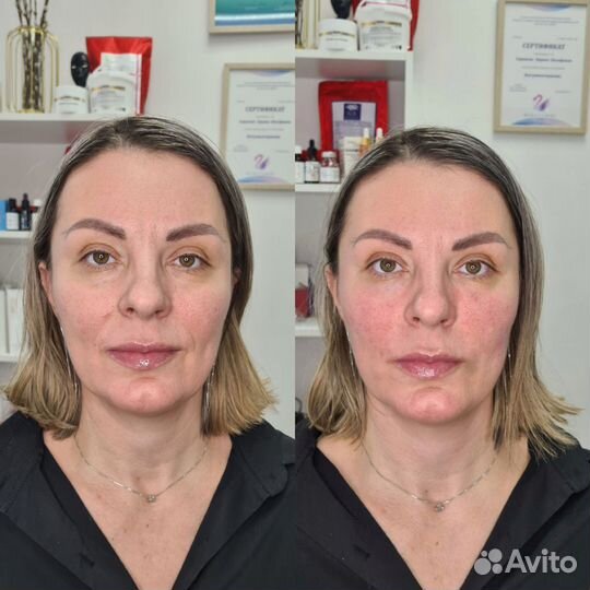 Обучение косметологов