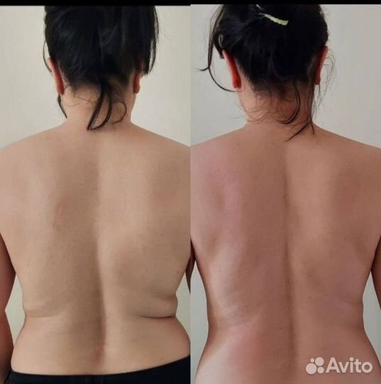 Аппаратная коррекция фигуры