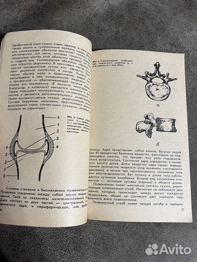 Заболевания суставов и позвоночника, медицинская