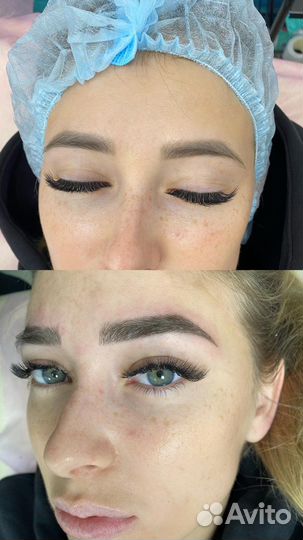 Микроблейдинг