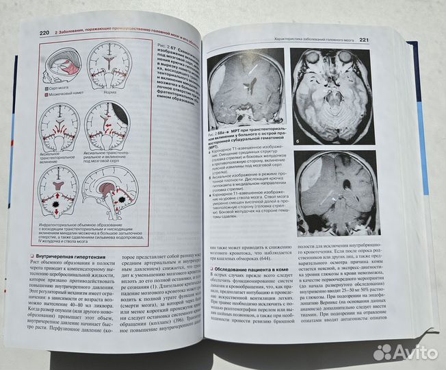 Неврология. 4-е изд Мументалер