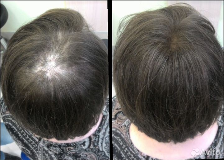 Загуститель для волос