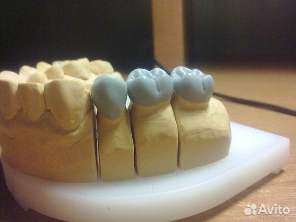 Зубной техник