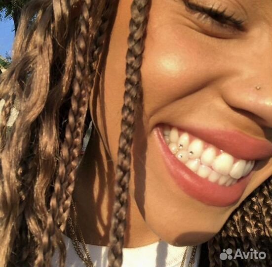 Установка скайсов