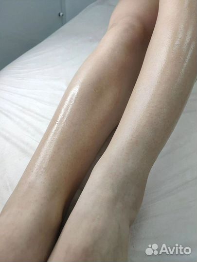 Лазерная эпиляция \ диодный лазер \ удаление волос