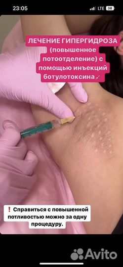 Ботокс для лица