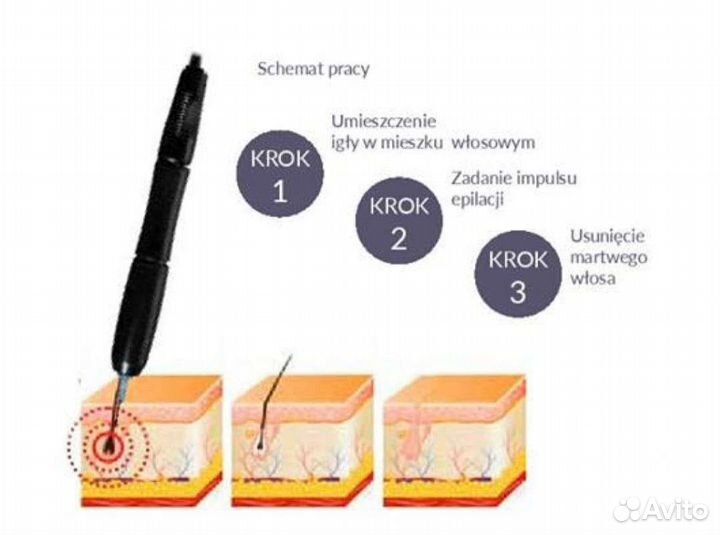 Электроэпилятор игольчатый Biomak EP400