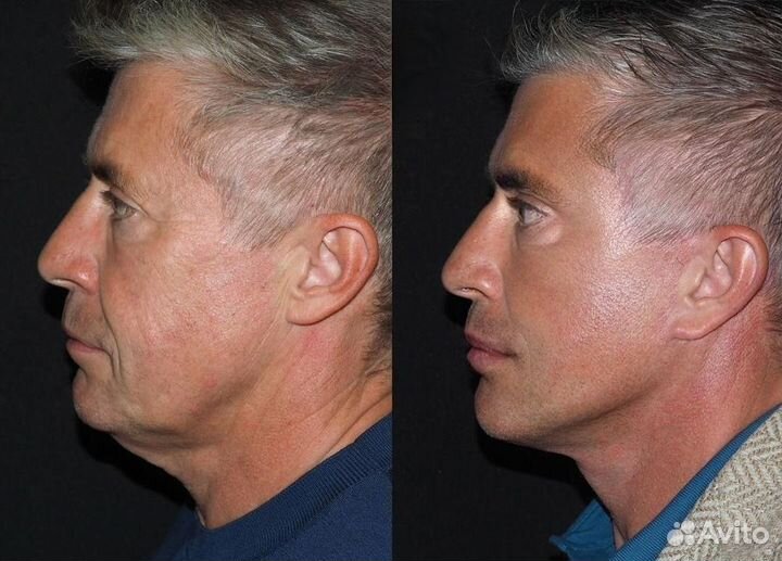 Программа омоложения для мужчин