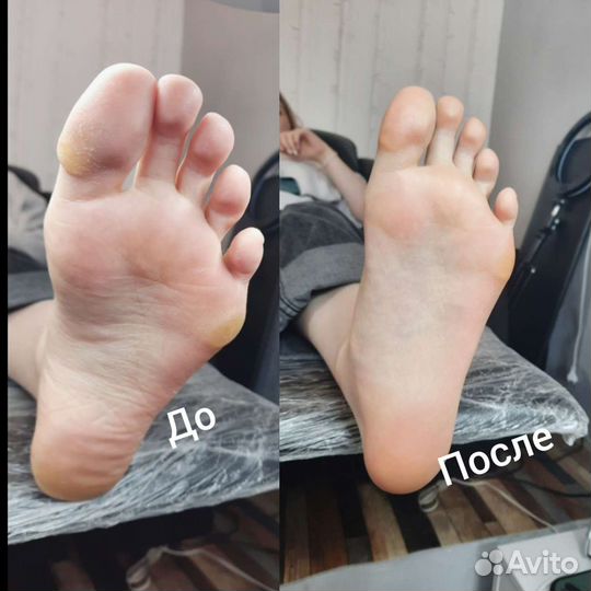 Маникюр и педикюр