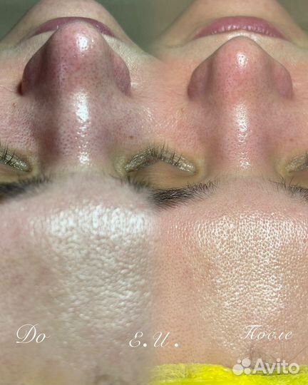 Косметолог- чистка лица, массаж, пилинг