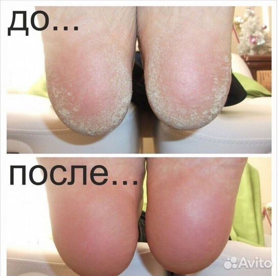 Smart педикюр