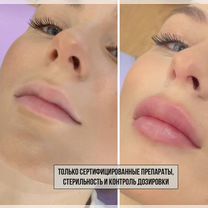 Косметолог с мед образованием увеличение губ, Красногорск
