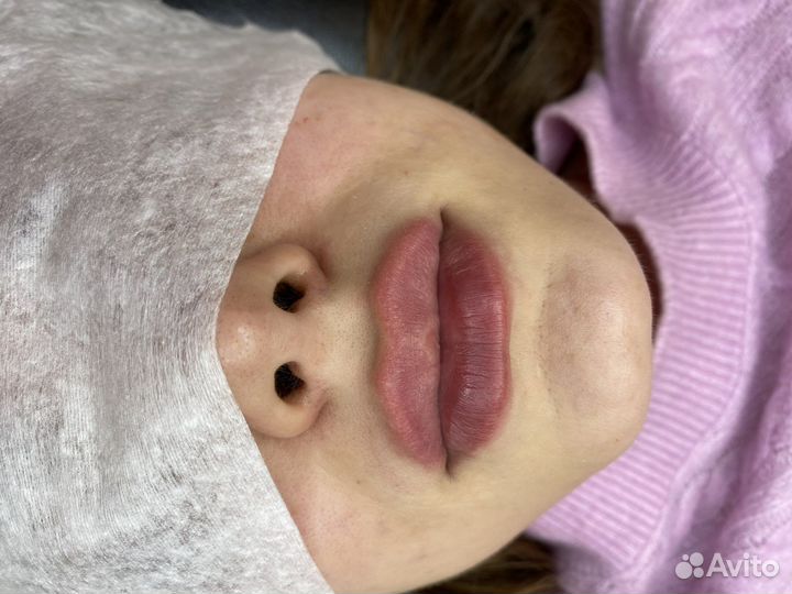 Косметолог - инъекционист