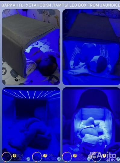 Уф лампа от желтушки