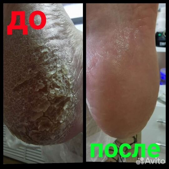 Подолог опытный