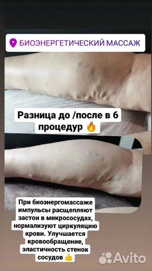 Массаж биоэнергетический