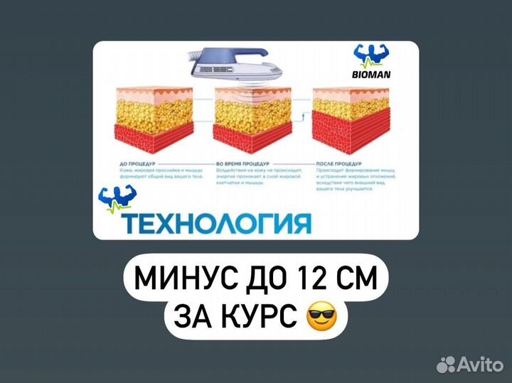 Похудение/Грозный/Мужское