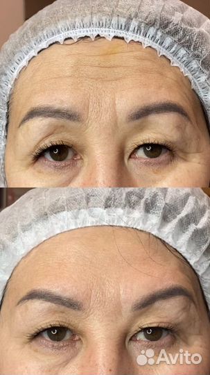 Косметолог - инъекционист