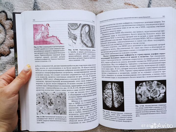 Книги по неврологии