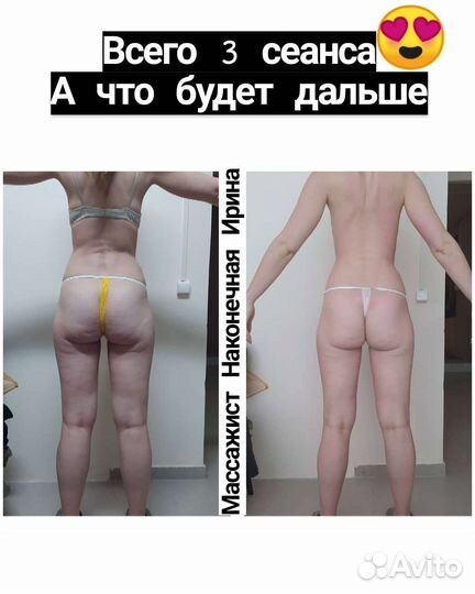 Массаж лечебный/Коррекция фигуры