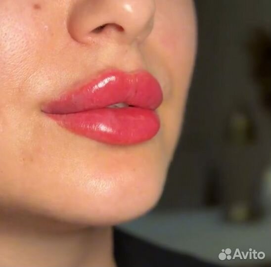 Увеличение губ плоский бант