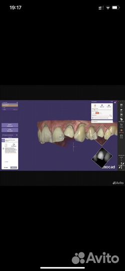 Установка Exocad +видеокурсы по желанию