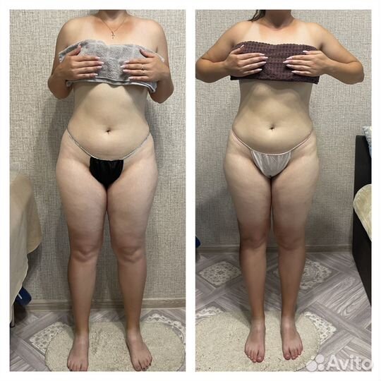 Аппаратный массаж