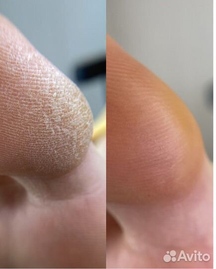 Курсы педикюра «Мастер-эстет»