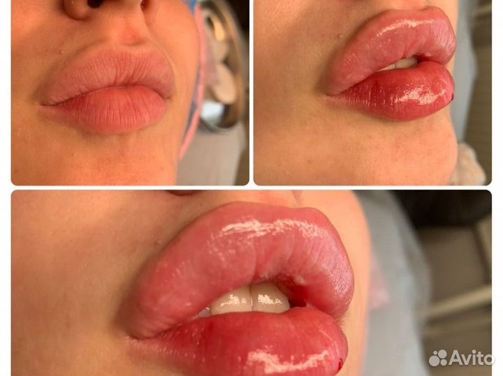 Косметолог(фото все мои )