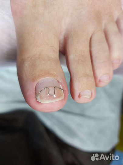 Подологический педикюр Маркс, район